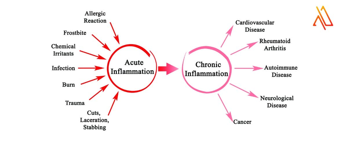 Inflammation and Pain